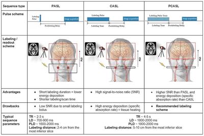 A Beginner's Guide to Arterial Spin Labeling (ASL) Image Processing